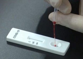 Koronavirüs testi taşıyan araca saldırı