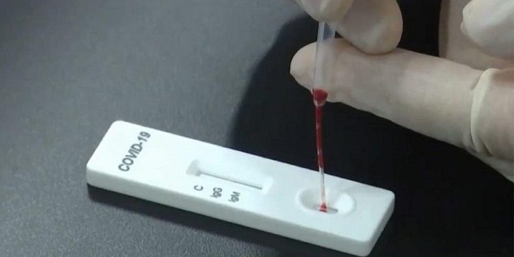 Koronavirüs testi taşıyan araca saldırı