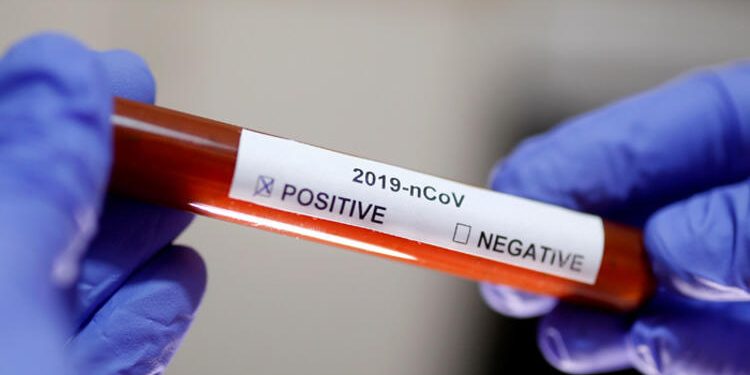 Türkiye’de 1 günde 18 kişi daha hayatını kaybetti