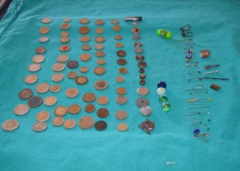 Çocukların yuttuğu cisimler hastanede sergilendi