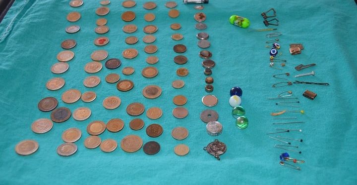 Çocukların yuttuğu cisimler hastanede sergilendi