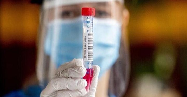 Rusya koronavirüs aşısını buldu!