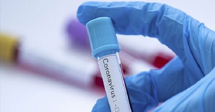 Risk grubundaki çalışanlar idari izinli sayılabilecek