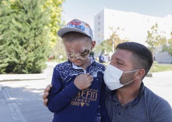 Cilt kanseri Salih’in tedavisi başladı