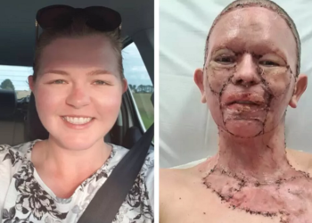 Uyuyakaldığı sandalye kamp ateşine devrildi!