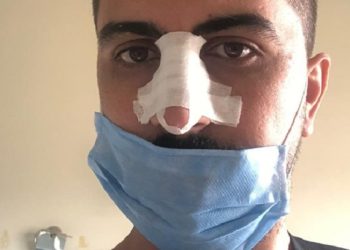 Saldırıya uğrayan hemşirenin isyanı: Şiddet Covid dinlemiyor