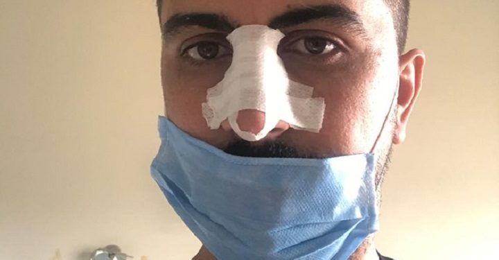 Saldırıya uğrayan hemşirenin isyanı: Şiddet Covid dinlemiyor