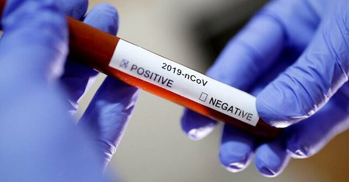 Covid-19 aşısı için heyecanlandıran açıklama