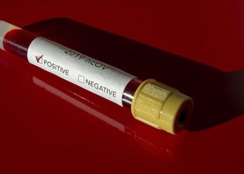 Covid-19’un yeni varyasyonu keşfedildi