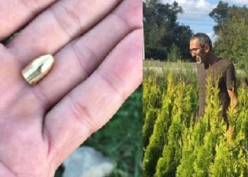 Bahçede gezerken başına mermi isabet etti