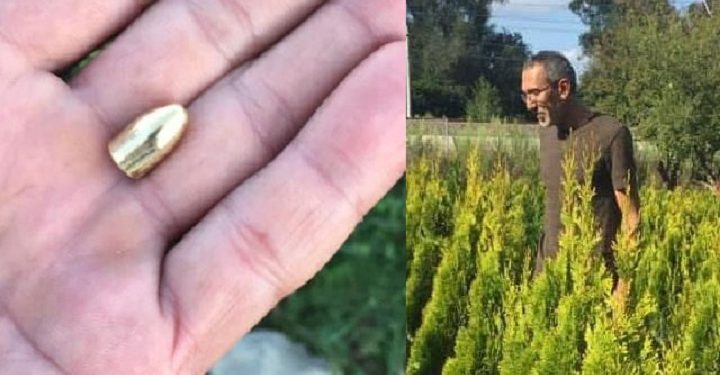 Bahçede gezerken başına mermi isabet etti