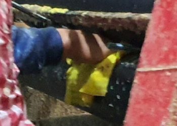 Bursa’da bir işçi kolunu makinaya kaptırdı!