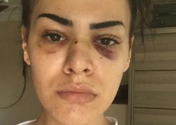 Tacizciler, genç kadını bu hale getirdi