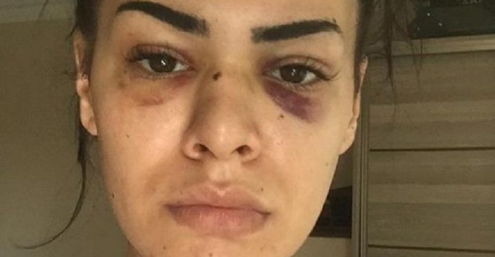 Tacizciler, genç kadını bu hale getirdi