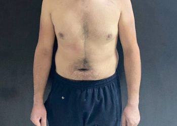 Altındağdaki̇ Bıçaklı Saldırının Zanlıları Tutuklanarak Cezaevi̇ne Gönderi̇ldi̇