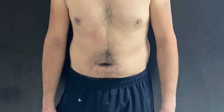 Altındağdaki̇ Bıçaklı Saldırının Zanlıları Tutuklanarak Cezaevi̇ne Gönderi̇ldi̇