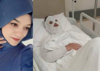 Eski nişanlısına kezzap attı