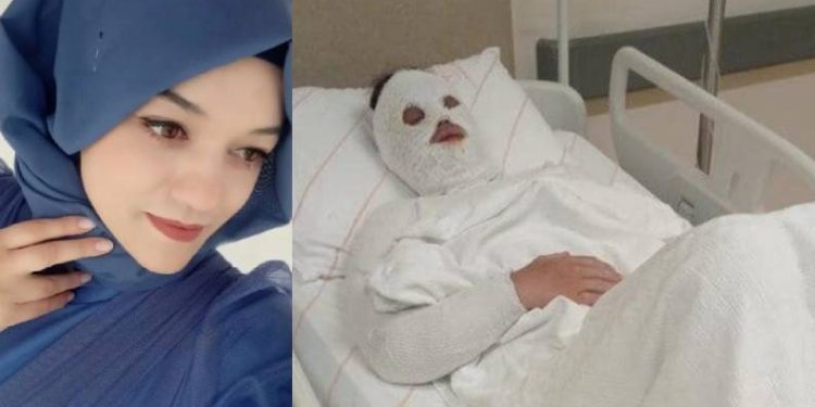 Eski nişanlısına kezzap attı