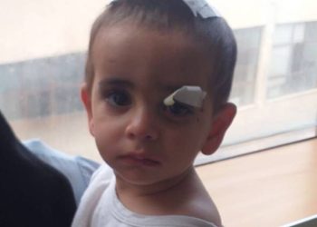 Köpeklerin saldırısına uğrayan çocuk hayatını kaybetti