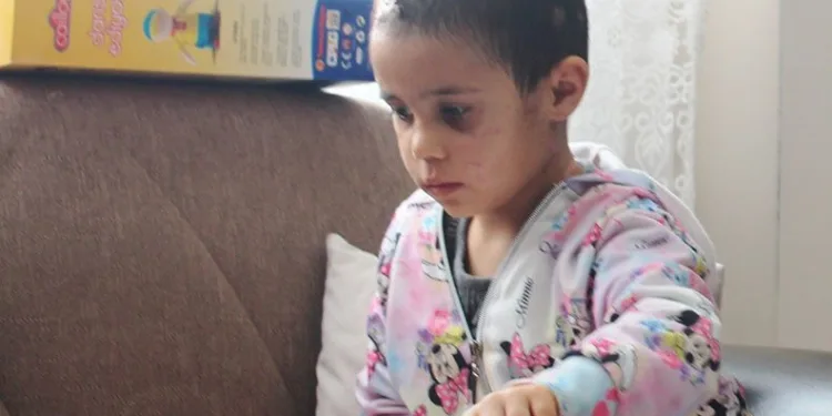 Pitbull saldırısına uğrayan Asiye’nin görüntüleri tepki topladı