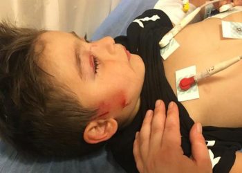 3 yaşındaki çocuk köpeklerin saldırısına uğradı