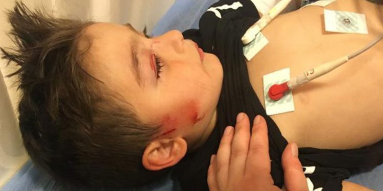 3 yaşındaki çocuk köpeklerin saldırısına uğradı