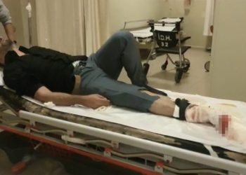 Bursa’da sokak ortasında bacağından vuruldu