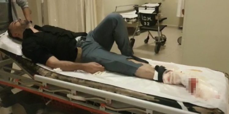 Bursa’da sokak ortasında bacağından vuruldu