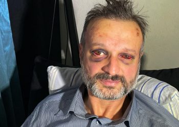 Bursa’da müzisyene darp olayında 9 kişi serbest