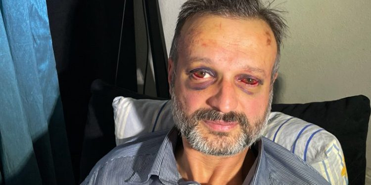 Bursa’da müzisyene darp olayında 9 kişi serbest