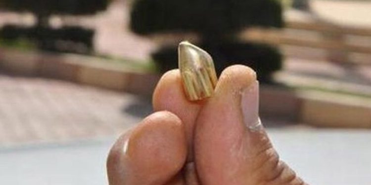 Trabzon’da yorgun mermi vakaları bitmiyor