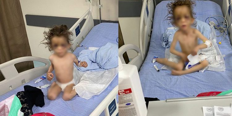 Şiddet ve açlığa maruz kalan çocuğun babası konuştu