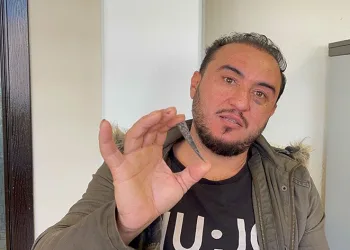 Çekilen röntgenle hayatının şokunu yaşadı