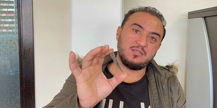 Çekilen röntgenle hayatının şokunu yaşadı