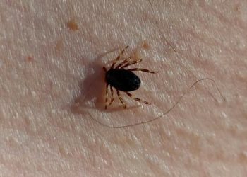 Kene vakaları yükselişte