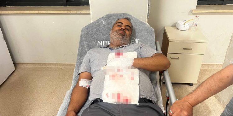 Mermi bahçede otururken isabet etti