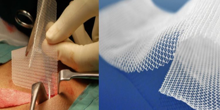 BUÜ’lü akademisyenin projesi “fıtık” oluşumunu engelleyecek