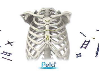 Göğüs kemiği kapatma plakası