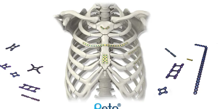 Göğüs kemiği kapatma plakası