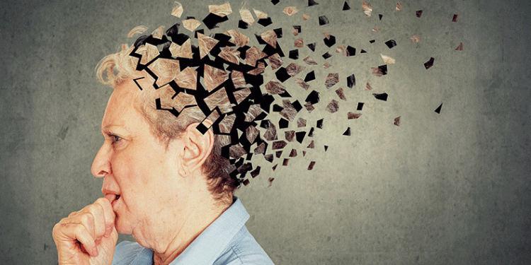 “Alzheimer” sayısı 10yıl içinde 135milyona çıkabilir