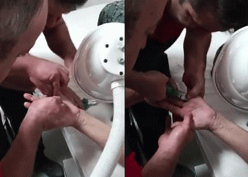 Yüzüğe sıkışan parmağı itfaiye kurtardı