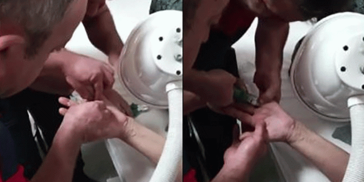 Yüzüğe sıkışan parmağı itfaiye kurtardı