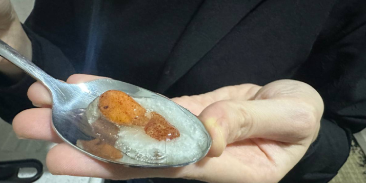 Kek yapmak isterken şoke oldu