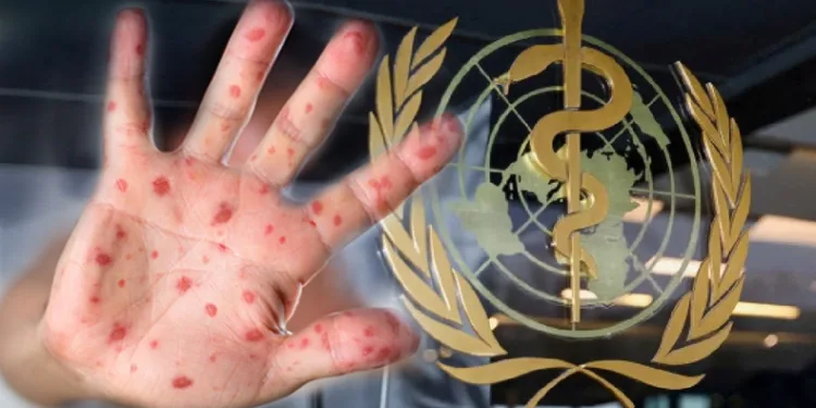 DSÖ’den Maymun Çiçeği açıklaması