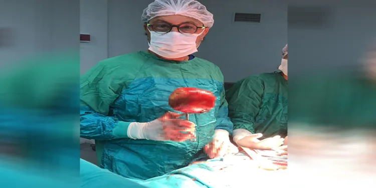 Ağrı şikayetiyle gitti, mesanesinden 1 kilogramlık taş çıkarıldı