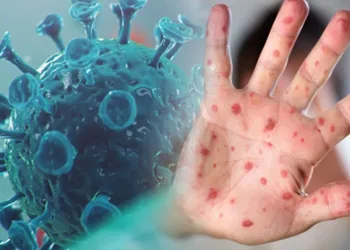 Sağlık Bakanlığı ‘maymun çiçeği rehberi’ yayımladı