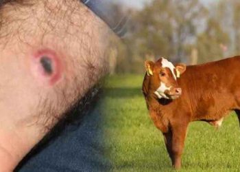 Güroymak’ta şarbon hastalığı tespit edildi