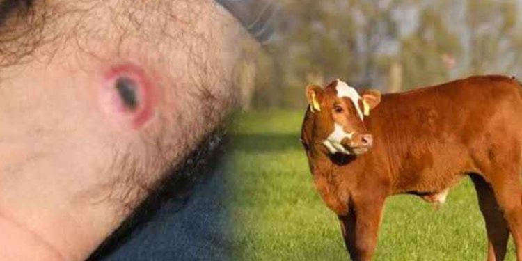 Güroymak’ta şarbon hastalığı tespit edildi