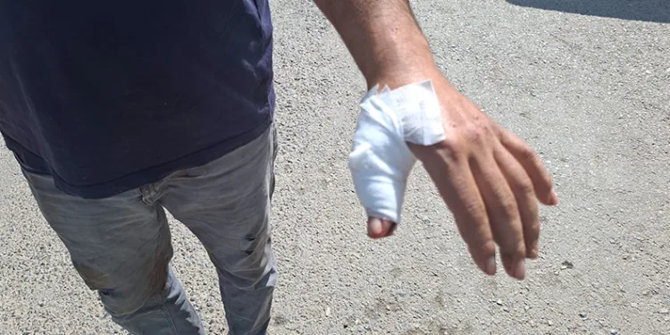 Kahramanmaraş’ta acemi kasaplar hastaneye koştu