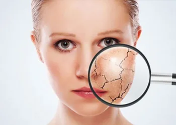 Cildiniz için kışa hazırlık reçetesi